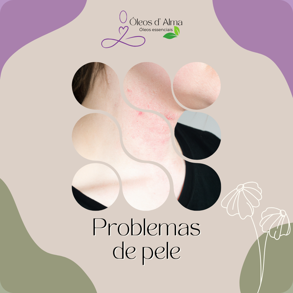 Problemas de pele